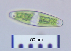 Closterium navicula