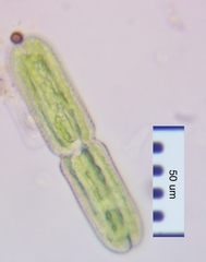 Tetmemorus brebissonii