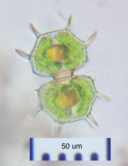 Xanthidium cristatum