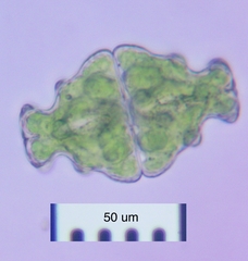 Euastrum ampullaceum