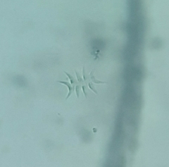 Tetradesmus lagerheimii