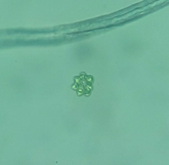 Coelastrum