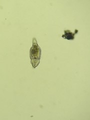 Philodina megalotrocha