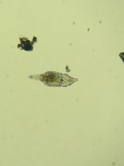 Philodina megalotrocha