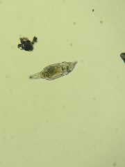 Philodina megalotrocha