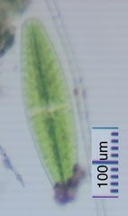 Netrium digitus