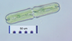 Tetmemorus brebissonii