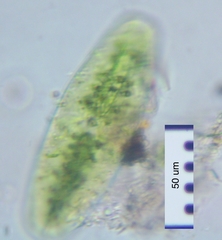 Netrium digitus