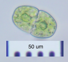 Cosmarium pseudopyramidatum