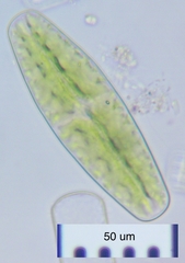 Netrium digitus