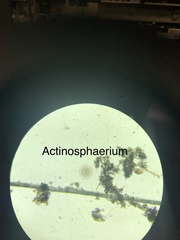 Actinosphaerium