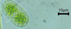 Cylindrocystis
