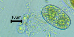 Cylindrocystis