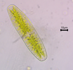Netrium digitus