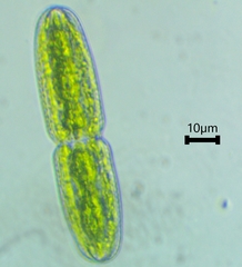 Tetmemorus brebissonii