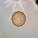 Coscinodiscus oculus-iridis - Photo (c) Sarka Martinez, some rights reserved (CC BY-NC), uploaded by Sarka Martinez