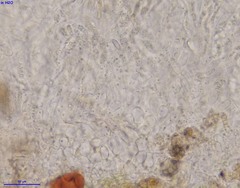Pezizellaceae