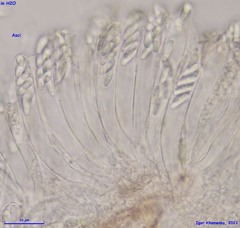 Pezizellaceae