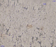 Hymenoscyphus imberbis