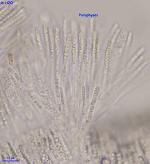 Hymenoscyphus imberbis