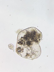 Vorticella