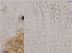 Pezizellaceae