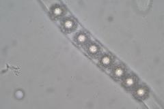 Octospora tuberculata