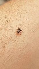 Pseudeuophrys lanigera