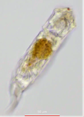 Cephalodella forficula