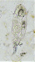 Cephalodella forficula