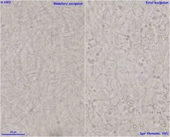 Hymenoscyphus imberbis