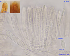 Hymenoscyphus imberbis