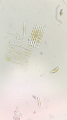 Cymbella