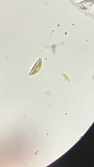 Cymbella