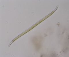Stenopterobia sigmatella