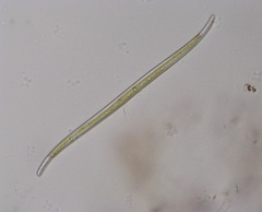 Stenopterobia sigmatella