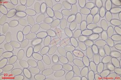 Peziza ampliata