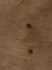 Amblyomma americanum