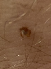 Amblyomma americanum