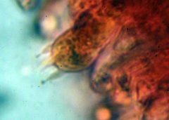 Rhodocybe malenconii