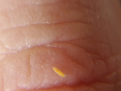 Thysanoptera