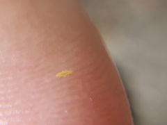 Thysanoptera
