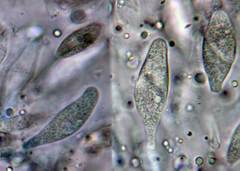 Sirobasidium brefeldianum