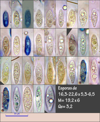 Sirobasidium brefeldianum
