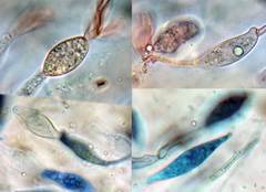 Sirobasidium brefeldianum