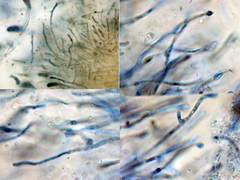 Sirobasidium brefeldianum