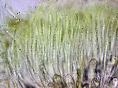Ascobolus furfuraceus
