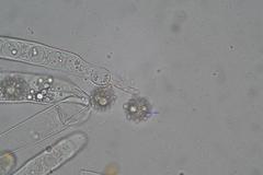 Octospora tuberculata