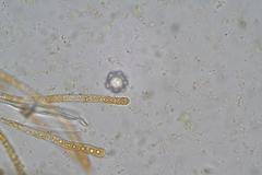 Octospora maireana