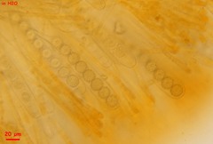 Ramsbottomia asperior